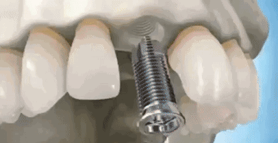 144120rlkjiwqzjpr6h6qj.gif