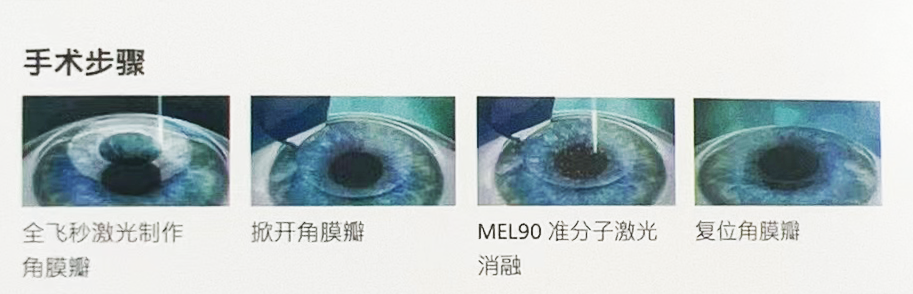 134819qor4b6bbv6b5lnnr.png