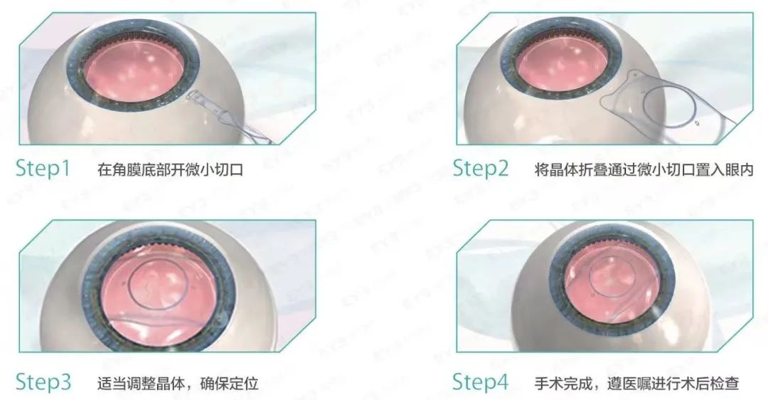 084209uji2c8j2es9zjv9q.jpeg