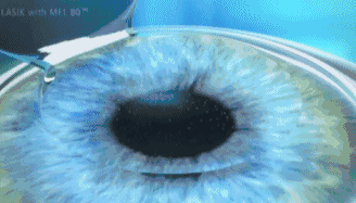 084210gvj4ept3vvsjh4io.gif