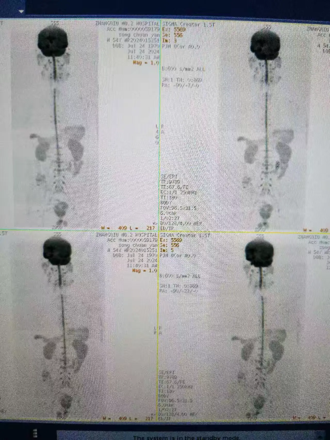101355lbq1q3311b2q531s.png