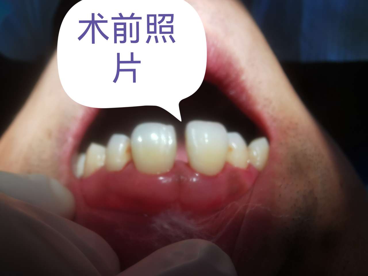 20250209164104front2_0_269237_FoNeWDt_DttOyI02LzZ2kS5WA1XU.jpg