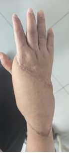 150404pvh8707x073ci3v3.png
